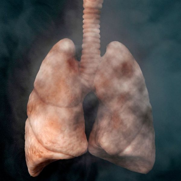 Ndalimi i duhanit përmirëson mbijetesën edhe pas diagnozës së kancerit të&nbsp;mushkërisë