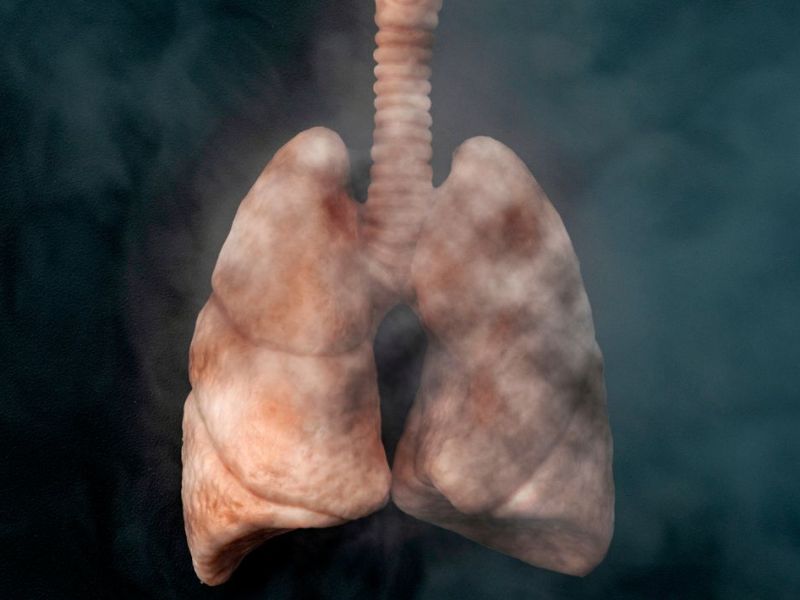 Ndalimi i duhanit përmirëson mbijetesën edhe pas diagnozës së kancerit të&nbsp;mushkërisë