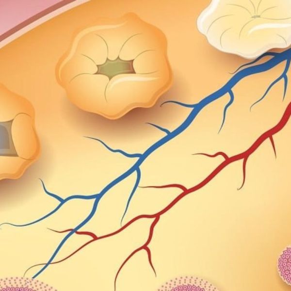 Si menaxhohet Insufiçenca Primare e&nbsp;Vezoreve?