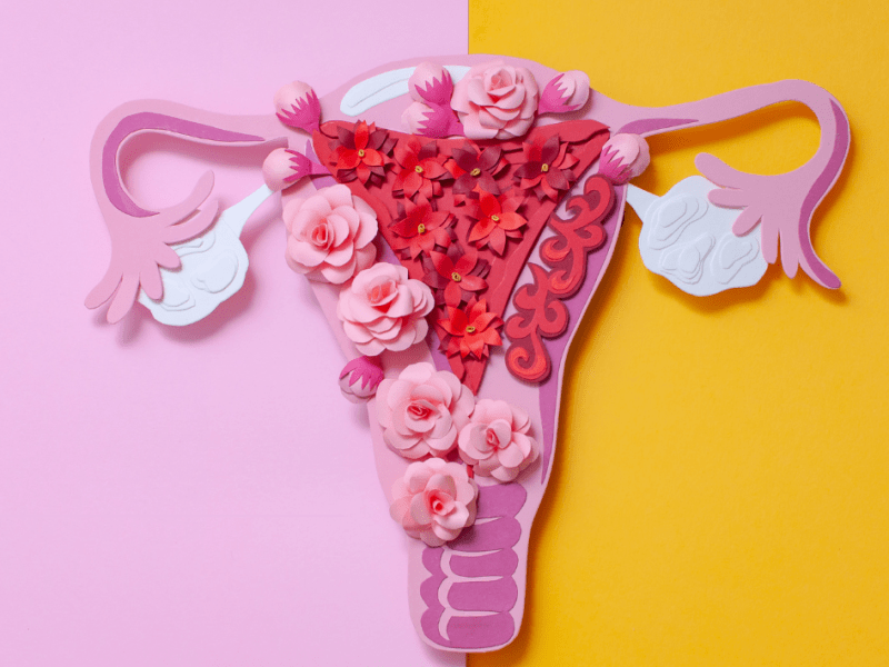 Endometrioza – sa rritet risku për kancer&nbsp;ovari?