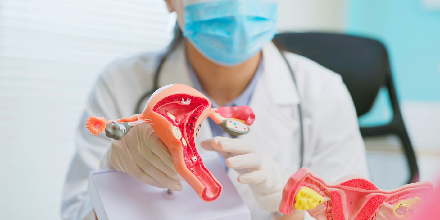 Kanceri i qafes se mitres