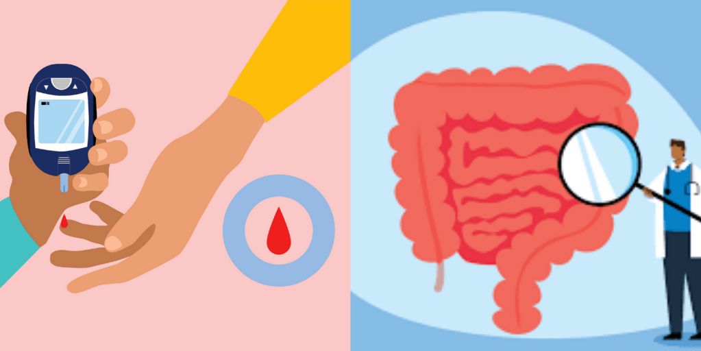 Diabeti dhe kanceri kolorektal
