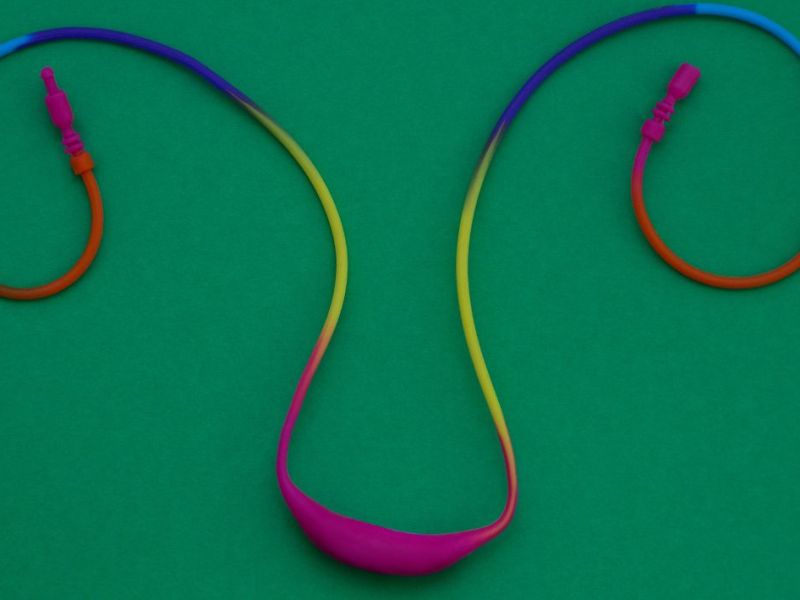 Kanceri i ovarit – kontroversitetet e&nbsp;trajtimit