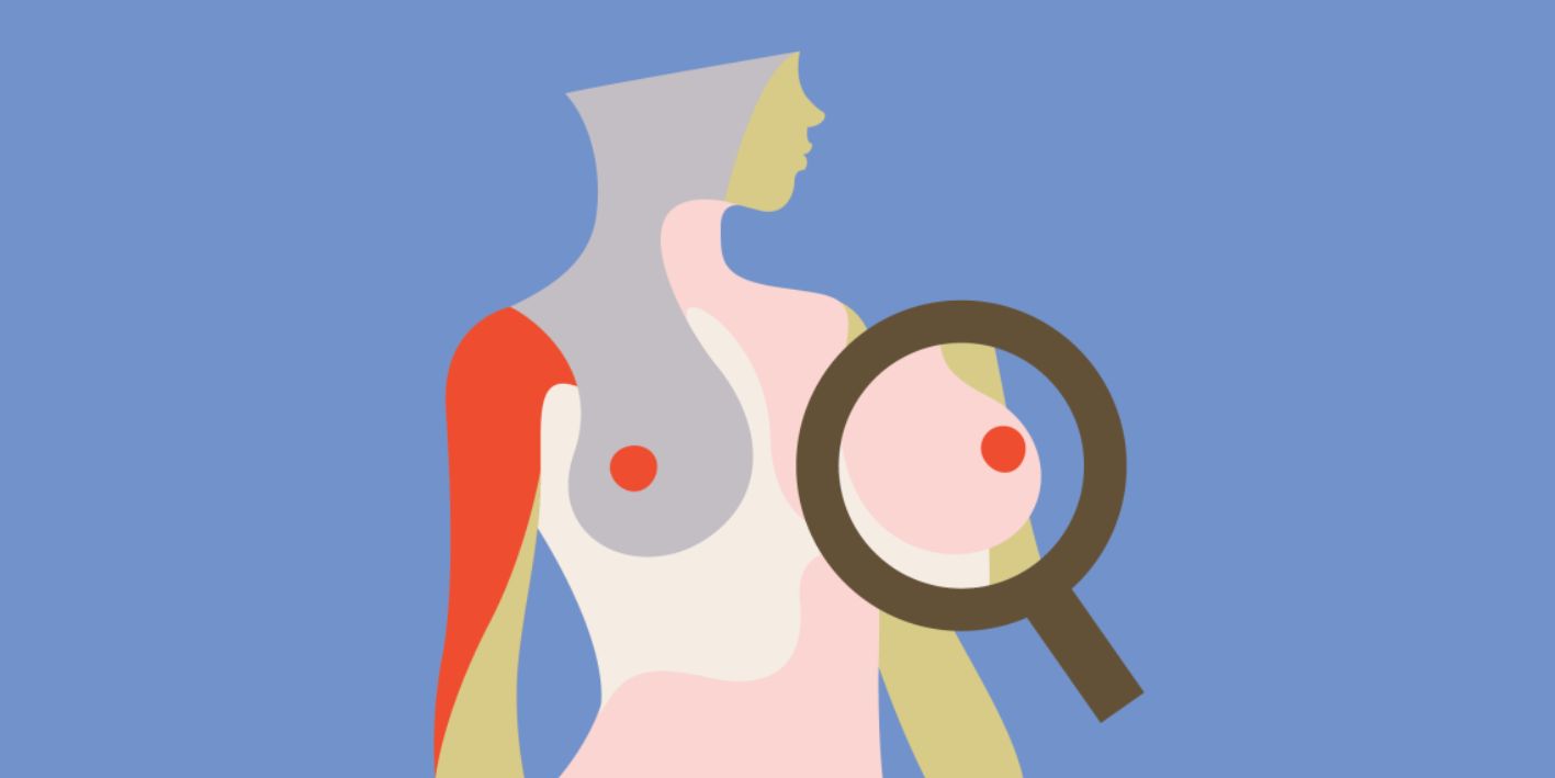 NATALEE - Ribociclib plus terapi endokrine ne trajtimin e kancerit te hershem te gjirit