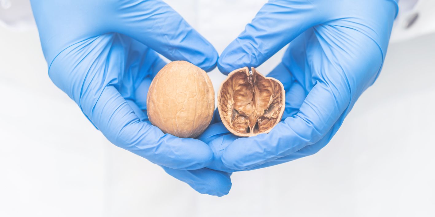 Kanceri testikular - Çfarë duhet të dimë?