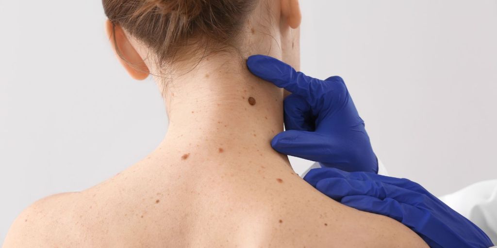 Kur duhet të shqetësoheni për nishanet?