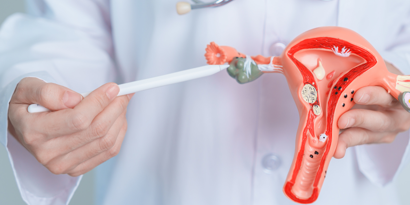 Depistimi i kancerit te ovarit