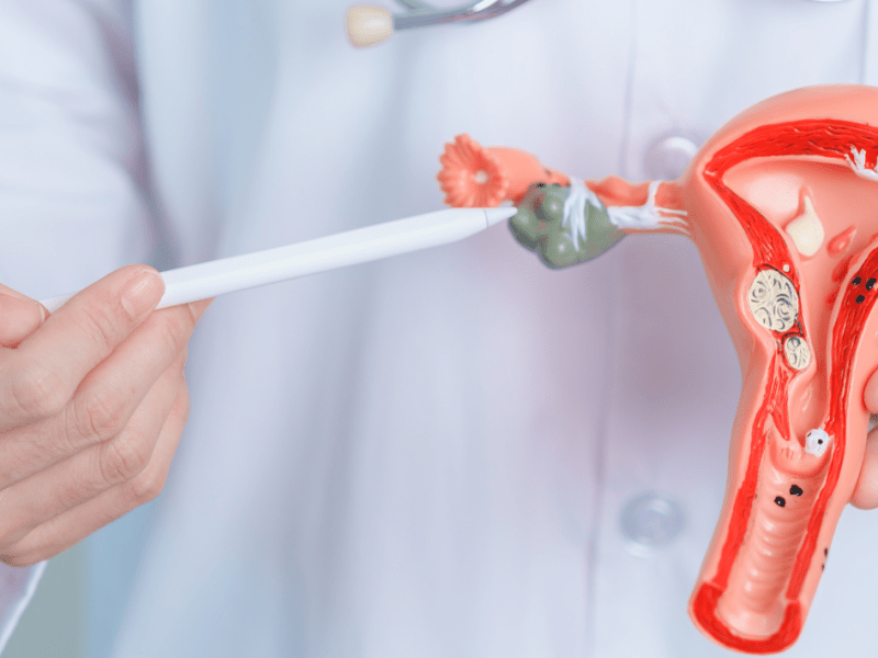 A është i mundur depistimi i kancerit të&nbsp;ovarit?