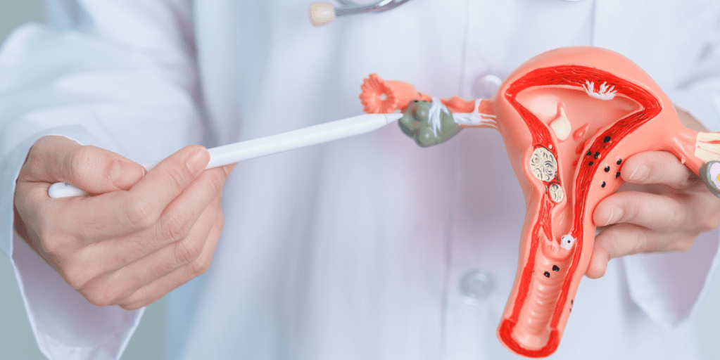 Depistimi i kancerit te ovarit