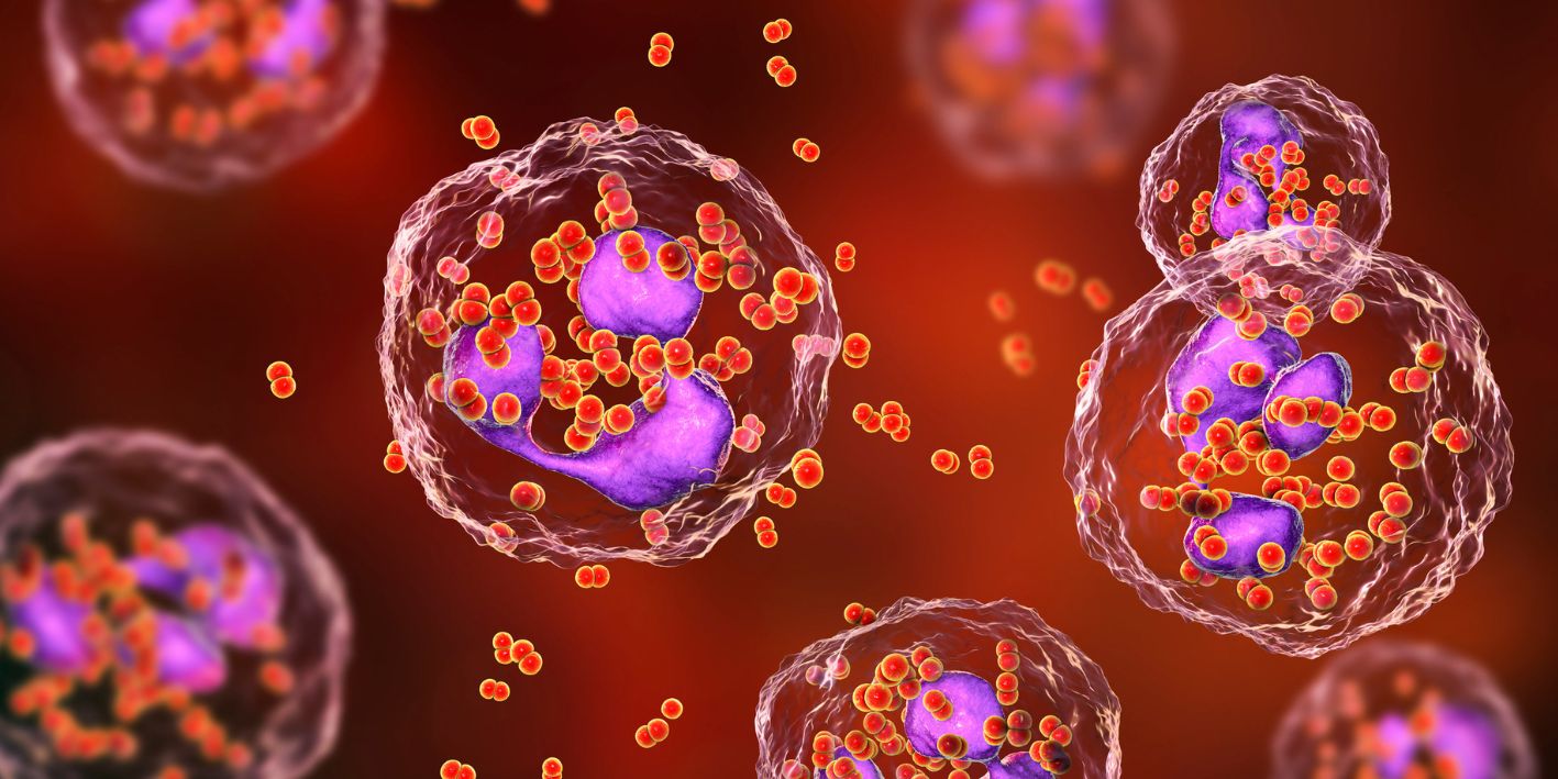 Neutropenia febrile