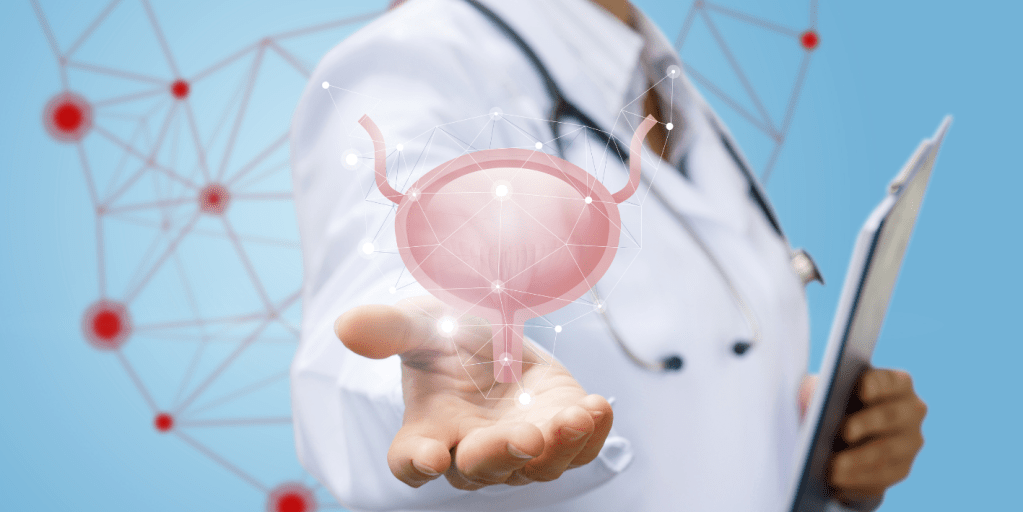 Kanceri i vezikës urinare