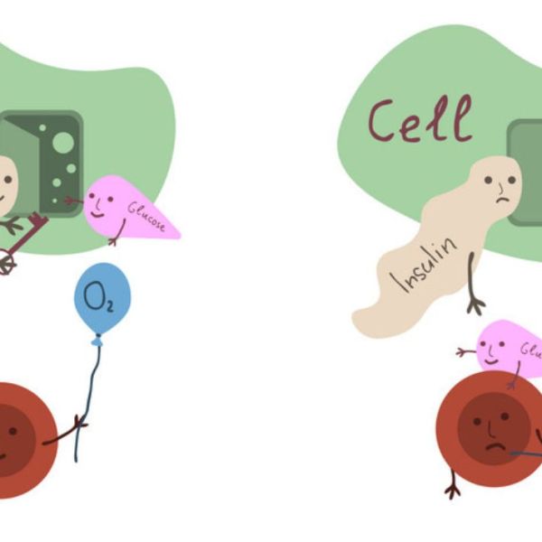 HOMA IR – treguesi i insulino-rezistencës