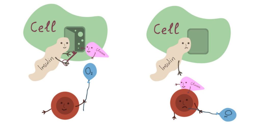 Rezistenca ndaj insulines