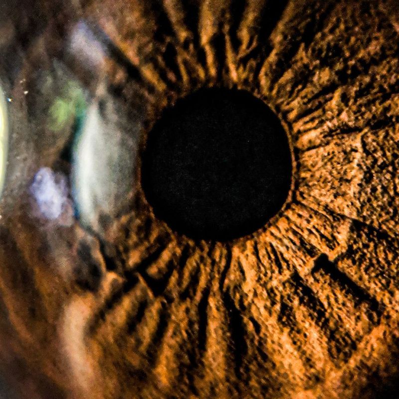 Prekja e syve nga&nbsp;Diabeti