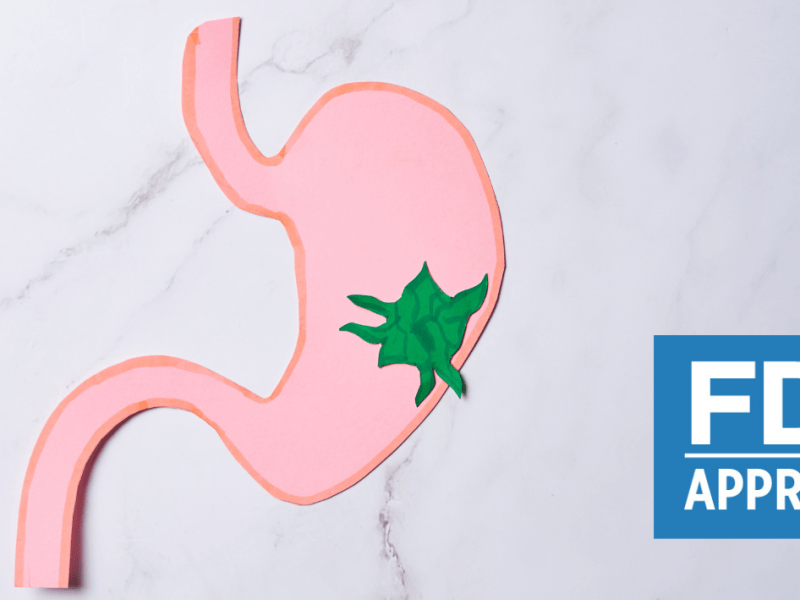 FDA aprovon trajtimin me Pembrolizumab + Trastuzumab + kimio ne adenokarcinomën gastrike të&nbsp;avancuar