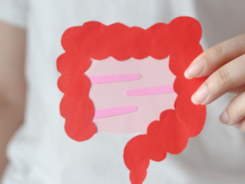 Kanceri i kolonit – simptomat dhe faktorët e&nbsp;riskut.