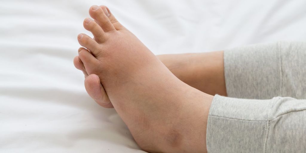 Edemat periferike ose ënjtja e këmbëve dhe/ose duarve.