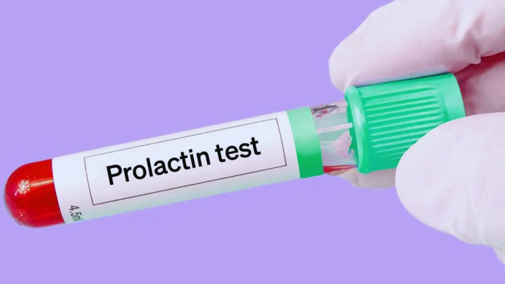 Testi i prolaktines