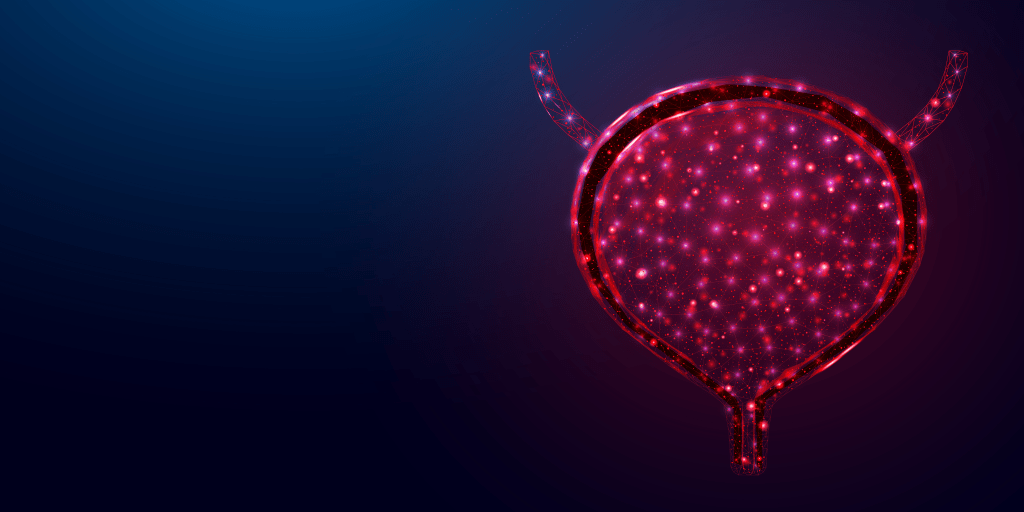 Kanceri i vezikes - atezolizumab pas ctDNA